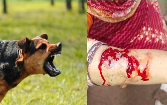 পাগলা কুকুরের আক্রমণে আহত ১৮ জন, বেশিরভাগই শিশু